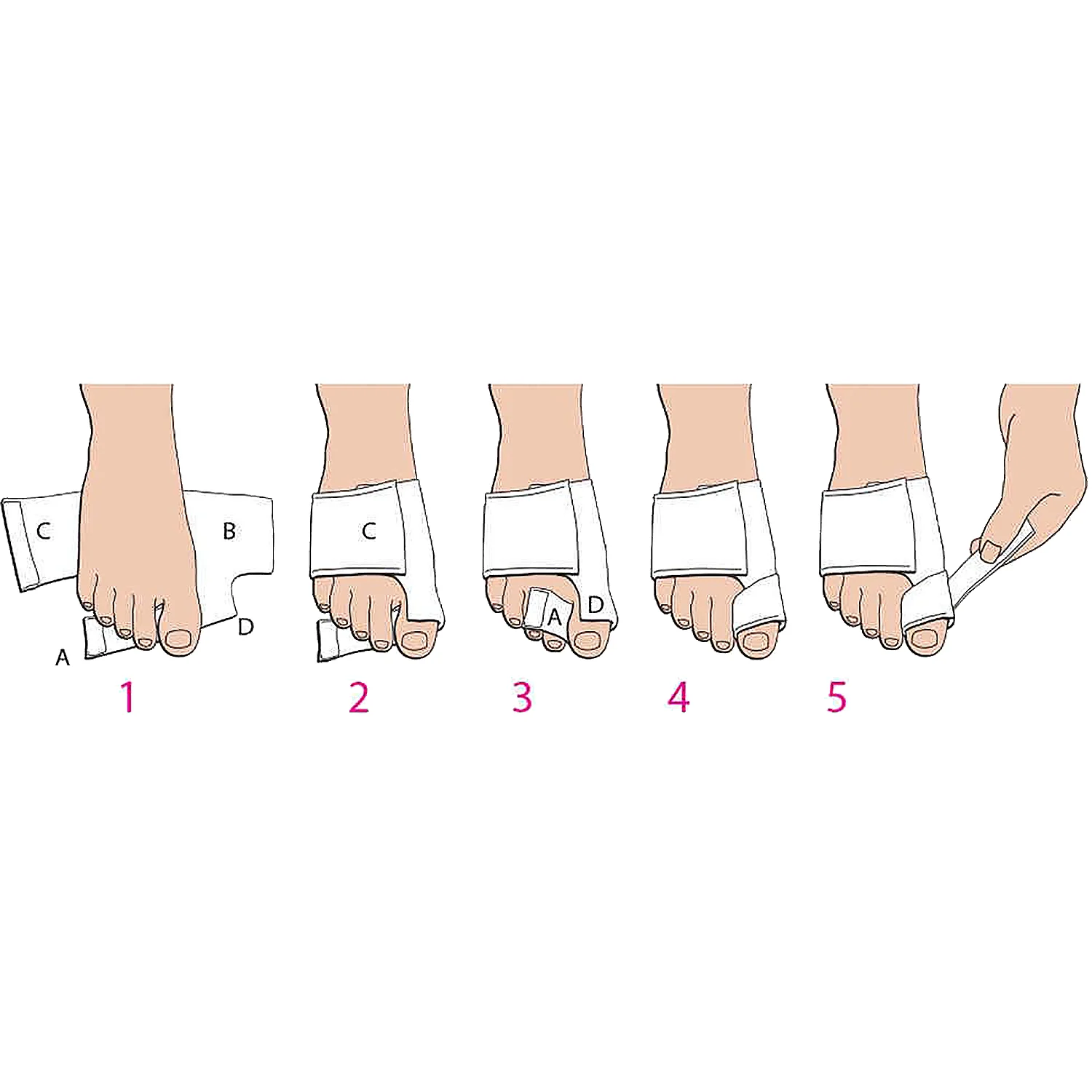 PediFix Bunion SoftSplint Unisex Fabric Foot Splint - Image 3